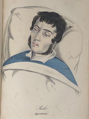 Lot 304, Auction  122, Baumgärtner, Karl  Heinrich, Kranken-Physiognomik